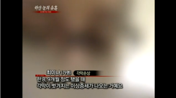 2011년에 퇴출된 성형수술 | 인스티즈
