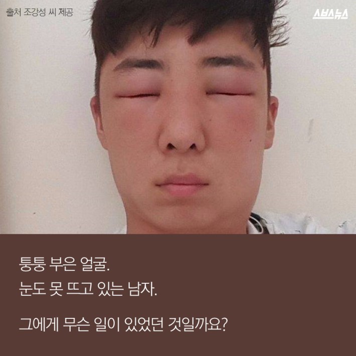 염색약 바르는데 피부가 부어오른 이유 | 인스티즈