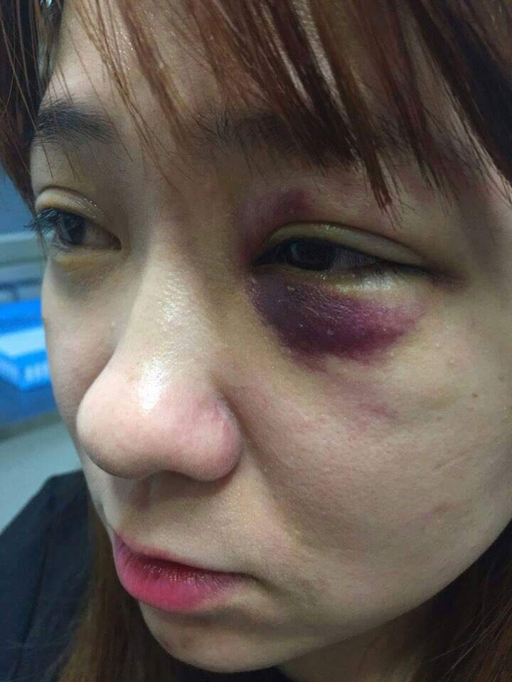 전라도 광주에서 남자 4명이 남자1명 여자2명 폭행하고 도망감 | 인스티즈