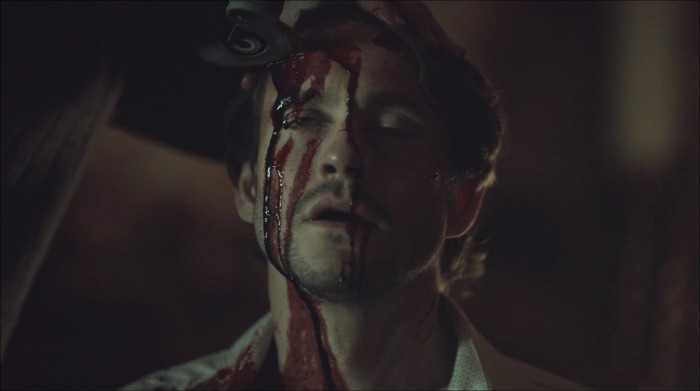 [로맨틱스릴러미드] 한니발 (Hannibal) 시즌3 에피7 (1/4) | 인스티즈