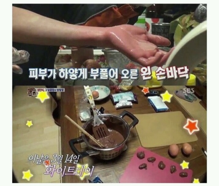 여자친구한테 줄 사탕만들다가 화상입은 남자친구 | 인스티즈