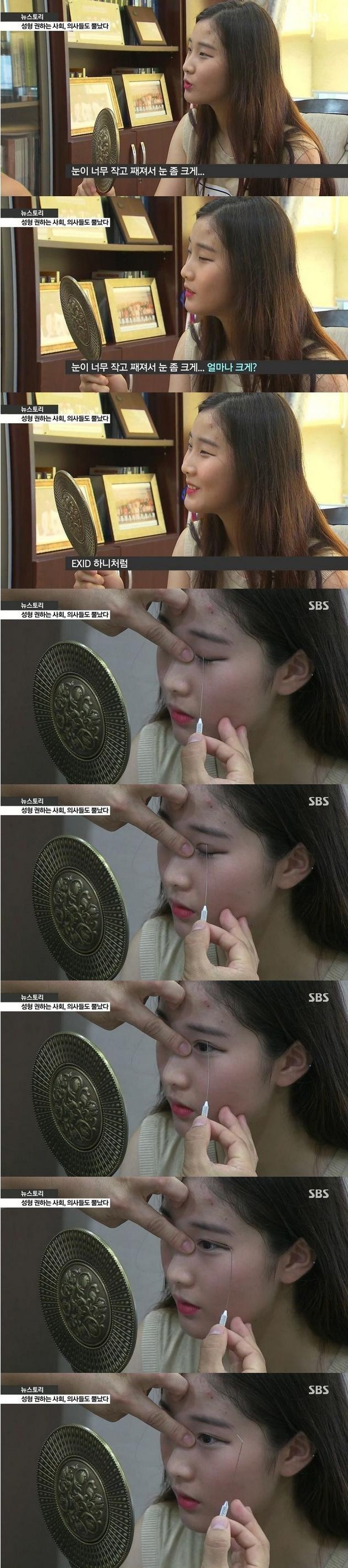 여자들이 쌍수를 하는 이유 | 인스티즈